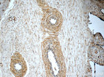 PERK/EIF2AK3 Antibody in Immunohistochemistry (Paraffin) (IHC (P))