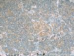 PERK/EIF2AK3 Antibody in Immunohistochemistry (Paraffin) (IHC (P))