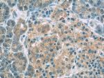 PERK/EIF2AK3 Antibody in Immunohistochemistry (Paraffin) (IHC (P))