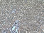 PERK/EIF2AK3 Antibody in Immunohistochemistry (Paraffin) (IHC (P))