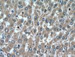 PERK/EIF2AK3 Antibody in Immunohistochemistry (Paraffin) (IHC (P))