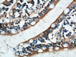 TRIM16 Antibody in Immunohistochemistry (Paraffin) (IHC (P))