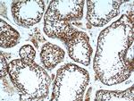 TRIM16 Antibody in Immunohistochemistry (Paraffin) (IHC (P))