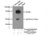 TRIM16 Antibody in Immunoprecipitation (IP)