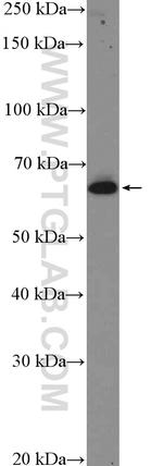 TRIM16 Antibody in Western Blot (WB)