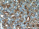 ACPP Antibody in Immunohistochemistry (Paraffin) (IHC (P))