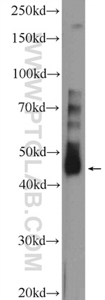 TFB2M Antibody in Western Blot (WB)