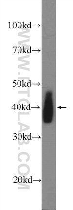 TFB2M Antibody in Western Blot (WB)