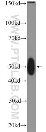 TFB2M Antibody in Western Blot (WB)