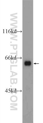 ATG14/Barkor (C-terminal) Antibody in Western Blot (WB)