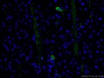 CHAT Antibody in Immunohistochemistry (PFA fixed) (IHC (PFA))