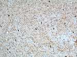 CHAT Antibody in Immunohistochemistry (Paraffin) (IHC (P))