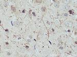 CHAT Antibody in Immunohistochemistry (Paraffin) (IHC (P))