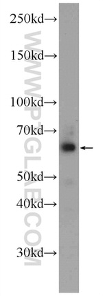 CHAT Antibody in Western Blot (WB)