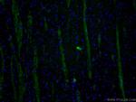 CHAT Antibody in Immunohistochemistry (PFA fixed) (IHC (PFA))