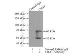 CHAT Antibody in Immunoprecipitation (IP)