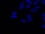 TALPID3 Antibody in Immunocytochemistry (ICC/IF)