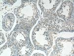 SPAG9 Antibody in Immunohistochemistry (Paraffin) (IHC (P))