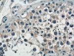 SPAG9 Antibody in Immunohistochemistry (Paraffin) (IHC (P))