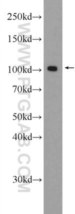 SPAG9 Antibody in Western Blot (WB)