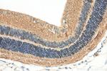 RS1 Antibody in Immunohistochemistry (Paraffin) (IHC (P))