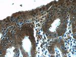 NUP205 Antibody in Immunohistochemistry (Paraffin) (IHC (P))