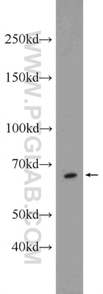 EXOSC9 Antibody in Western Blot (WB)