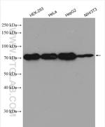 EXOSC9 Antibody in Western Blot (WB)