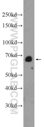 EXOSC9 Antibody in Western Blot (WB)