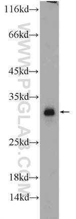 C20orf11 Antibody in Western Blot (WB)