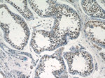 PRPF39 Antibody in Immunohistochemistry (Paraffin) (IHC (P))