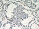 PRPF39 Antibody in Immunohistochemistry (Paraffin) (IHC (P))