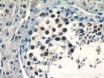 PRPF39 Antibody in Immunohistochemistry (Paraffin) (IHC (P))