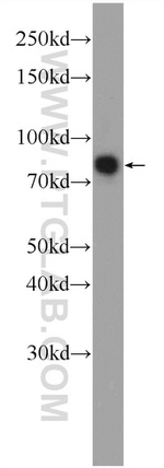 PRPF39 Antibody in Western Blot (WB)