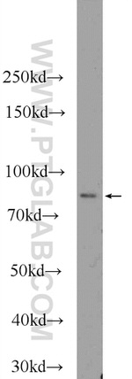 PRPF39 Antibody in Western Blot (WB)