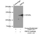 PHF12 Antibody in Immunoprecipitation (IP)