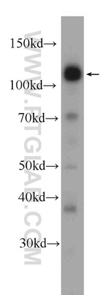 PHF12 Antibody in Western Blot (WB)