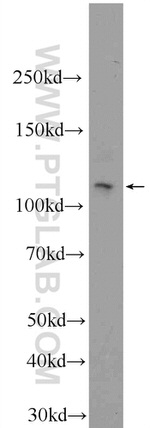 PHF12 Antibody in Western Blot (WB)