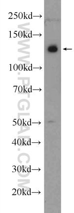 PHF12 Antibody in Western Blot (WB)