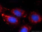 RRP7A Antibody in Immunocytochemistry (ICC/IF)