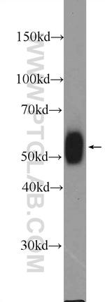 LCK Antibody in Western Blot (WB)