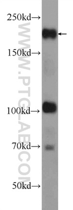ARID4B Antibody in Western Blot (WB)