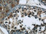 ARID4B Antibody in Immunohistochemistry (Paraffin) (IHC (P))