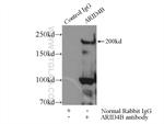 ARID4B Antibody in Immunoprecipitation (IP)