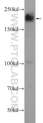 ARID4B Antibody in Western Blot (WB)