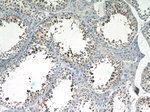 SALL4 Antibody in Immunohistochemistry (Paraffin) (IHC (P))