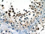 SALL4 Antibody in Immunohistochemistry (Paraffin) (IHC (P))