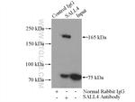 SALL4 Antibody in Immunoprecipitation (IP)