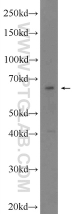 SALL4 Antibody in Western Blot (WB)