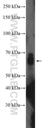 SALL4 Antibody in Western Blot (WB)